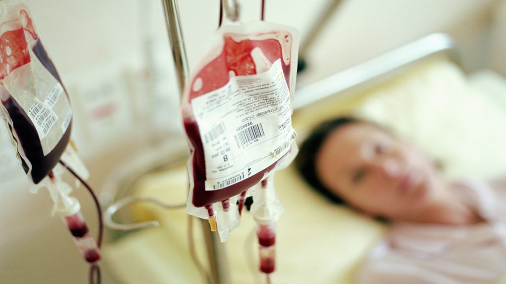 Blood Component Transfusion: Decision to Transfuse