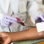 Blood Component Transfusion: Blood Sampling