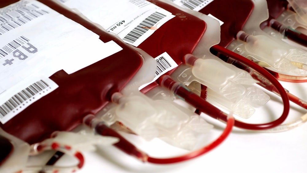Blood Component Transfusion : Collection, Storage and Delivery to the Clinical Area